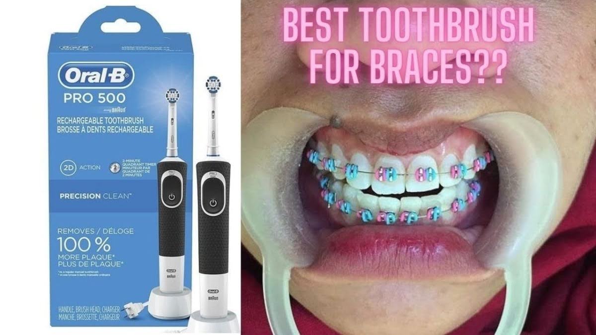 Best electric toothbrush for braces